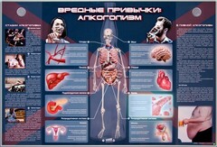 Электрифицированный стенд "Вредные привычки: алкоголизм" - fgospostavki.ru - Уфа